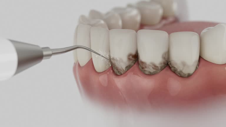 Trusted Emergency Dentist service in St. Joseph, IL - Dentist Open Now